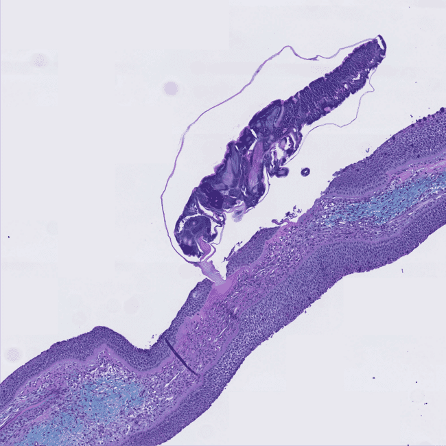 A microscope photo of a sealouce attaching to a fish.